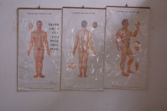DELTA DEL MEKONG - Sobborghi di Cai Rang: le tavole del corpo umano con indicati i punti nevralgici per la medicina cinese